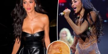 Nicole Scherzinger shows off gruesome injury after boiling water fell on her leg 1 hour before concert Nicole Scherzinger shows off gruesome injury after boiling water fell on her leg 1 hour before concert